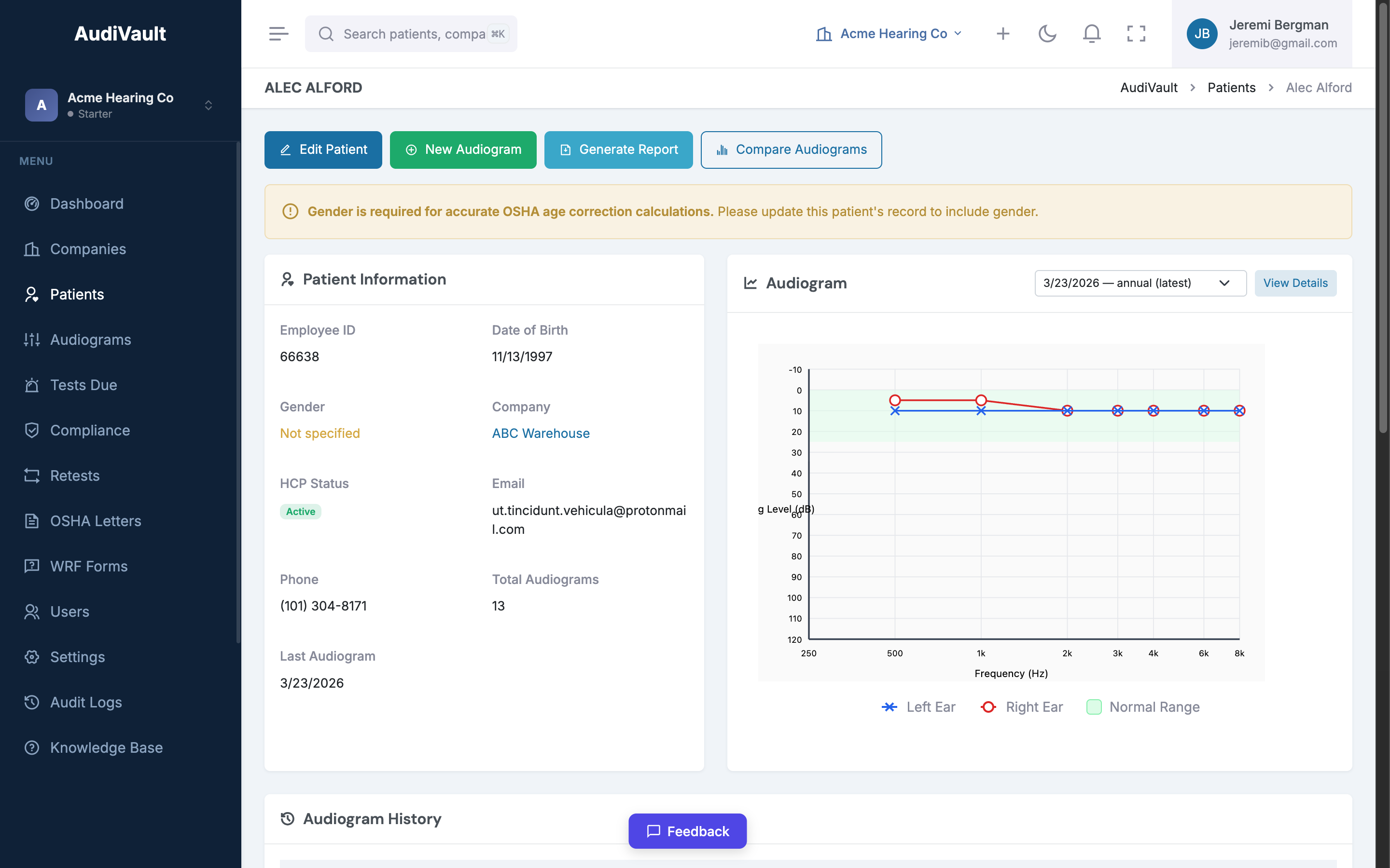 Patient audiogram chart showing hearing thresholds across frequencies